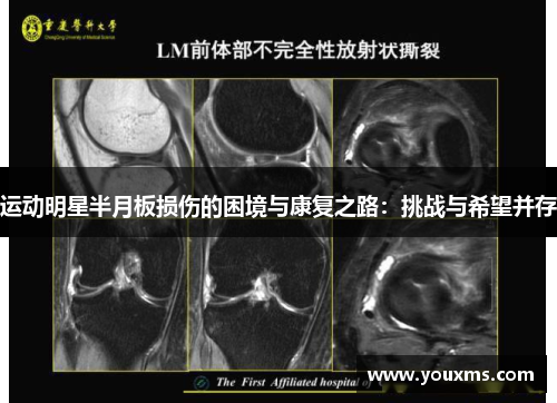运动明星半月板损伤的困境与康复之路：挑战与希望并存